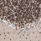 Anti-CCDC175 Antibody