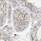 Immunohistochemical staining of human testis shows strong positivity in nuclear membrane in cells in seminiferous ducts.