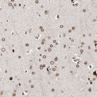 Anti-CCDC175 Antibody