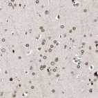 Immunohistochemical staining of human cerebral cortex shows strong positivity in nuclear membrane in neurons.