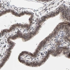 Immunohistochemical staining of human fallopian tube shows strong positivity in nuclear membrane in glandular cells.