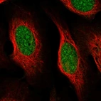 Immunofluorescent staining of human cell line U-2 OS shows localization to nucleus & nucleoli.