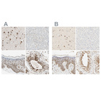 Immunohistochemical staining of human cerebral cortex, liver, skin and testis using Anti-DAZAP1 antibody HPA004201 (A) shows similar protein distribution across tissues to independent antibody HPA004631 (B).