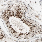 Immunohistochemical staining of human testis shows strong nuclear positivity in cells in seminiferous ducts.