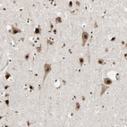 Immunohistochemical staining of human cerebral cortex shows strong nuclear positivity in neurons.