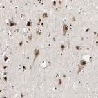 Immunohistochemical staining of human cerebral cortex shows strong nuclear positivity in neurons.