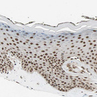 Immunohistochemical staining of human skin shows moderate to strong nuclear positivity in squamous epithelial cells.