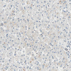 Immunohistochemical staining of human liver shows no weak positivity in hepatocytes as expected.