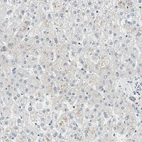Immunohistochemical staining of human liver shows no weak positivity in hepatocytes as expected.