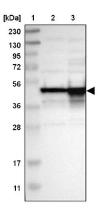 Lane 1: Marker [kDa] 230, 130, 95, 72, 56, 36, 28, 17, 11_br/_Lane 2: Human cell line RT-4_br/_Lane 3: Human cell line U-251MG sp