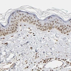 Immunohistochemical staining of human skin shows weak nuclear positivity in squamous epithelial cells.