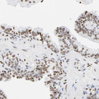 Anti-HOXA6 Antibody