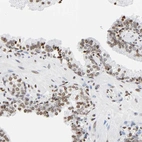Immunohistochemical staining of human prostate shows weak to moderate nuclear positivity in glandular cells.
