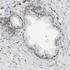 Anti-PRKAG2 Antibody