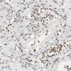 Anti-PRKAG2 Antibody