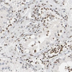 Immunohistochemical staining of human testis shows moderate to strong positivity in nuclear membrane in cells in seminiferous ducts.
