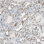 Immunohistochemical staining of human kidney shows moderate to strong positivity in nuclear membrane in cells in tubules.