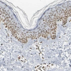 Immunohistochemical staining of human skin shows moderate to strong positivity in nuclear membrane in keratinocytes.