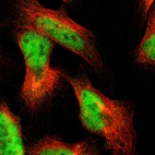 Immunofluorescent staining of human cell line U-2 OS shows localization to nucleoplasm.