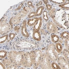 Immunohistochemical staining of human kidney shows moderate to strong cytoplasmic positivity in cells in tubules.