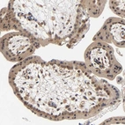 Immunohistochemical staining of human placenta shows moderate to strong cytoplasmic positivity in trophoblastic cells.