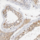 Immunohistochemical staining of human testis shows moderate cytoplasmic positivity in Leydig cells.