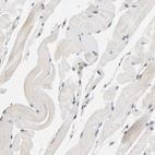 Anti-PRKAB1 Antibody