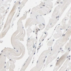 Immunohistochemical staining of human skeletal muscle shows no positivity in myocytes as expected.