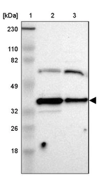 Lane 1: Marker [kDa] 230, 110, 82, 49, 32, 26, 18_br/_Lane 2: Human cell line RT-4_br/_Lane 3: Human cell line U-251MG sp