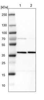 Lane 1: NIH-3T3 cell lysate (Mouse embryonic fibroblast cells)_br/_Lane 2: NBT-II cell lysate (Rat Wistar bladder tumour cells)