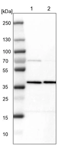Lane 1: NIH-3T3 cell lysate (Mouse embryonic fibroblast cells)_br/_Lane 2: NBT-II cell lysate (Rat Wistar bladder tumour cells)