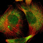 Anti-PRKAB1 Antibody