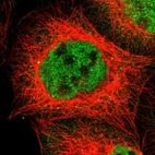 Immunofluorescent staining of human cell line A-431 shows localization to nucleoplasm & cytosol.