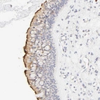 Anti-CYP4B1 Antibody