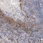 Immunohistochemical staining of human tonsil shows moderate to strong membranous positivity in squamous epithelial cells.