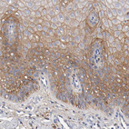 Anti-FGFBP1 Antibody