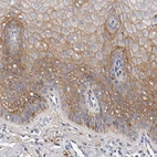 Immunohistochemical staining of human cervix shows moderate membranous positivity in squamous epithelial cells.