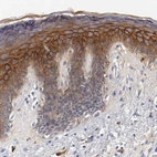 Immunohistochemical staining of human skin shows strong membranous positivity in squamous epithelial cells.