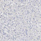 Anti-FGFBP1 Antibody
