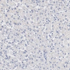 Immunohistochemical staining of human liver shows no positivity in hepatocytes as expected.