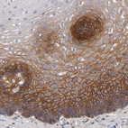 Immunohistochemical staining of human esophagus shows strong membranous positivity in squamous epithelial cells.