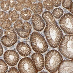 Immunohistochemical staining of human stomach shows strong membranous and cytoplasmic positivity in glandular cells.