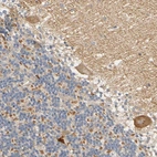 Immunohistochemical staining of human cerebellum shows moderate cytoplasmic positivity in Purkinje cells.