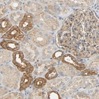 Immunohistochemical staining of human kidney shows strong membranous and cytoplasmic positivity in cells in distal tubules.