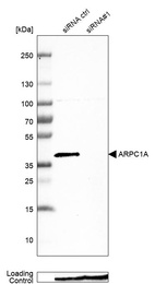 Anti-ARPC1A Antibody