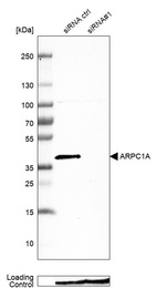 Western blot analysis in MCF-7 cells transfected with control siRNA, target specific siRNA probe #1, using Anti-ARPC1A antibody. Remaining relative intensity is presented. Loading control: Anti-PPIB.