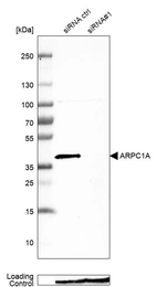 Western blot analysis in MCF-7 cells transfected with control siRNA, target specific siRNA probe #1, using Anti-ARPC1A antibody. Remaining relative intensity is presented. Loading control: Anti-PPIB.