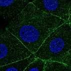 Immunofluorescent staining of human cell line MCF7 shows localization to cytosol & cell junctions.
