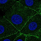 Immunofluorescent staining of human cell line MCF7 shows localization to cytosol & cell junctions.