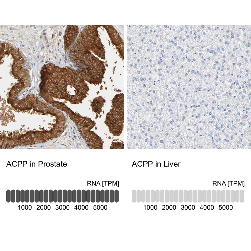 Anti-ACPP Antibody